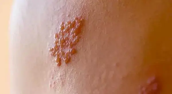 2026_4_3_21_47_57_118 (1)