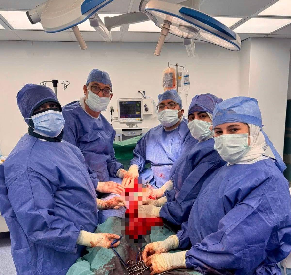 إنجاز طبي استثنائي في مستشفى العريش بشمال سيناء