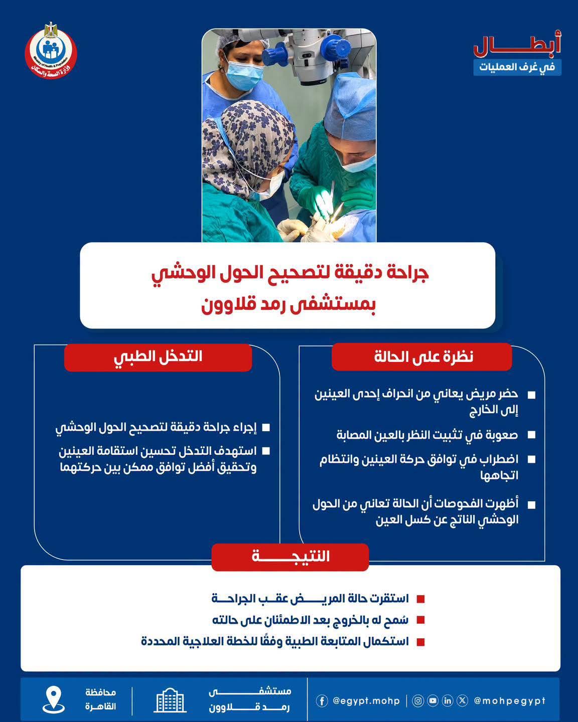 فريق طبي بمستشفى رمد قلاوون ينجح في إجراء جراحة دقيقة لتصحيح الحول الوحشي لمريض